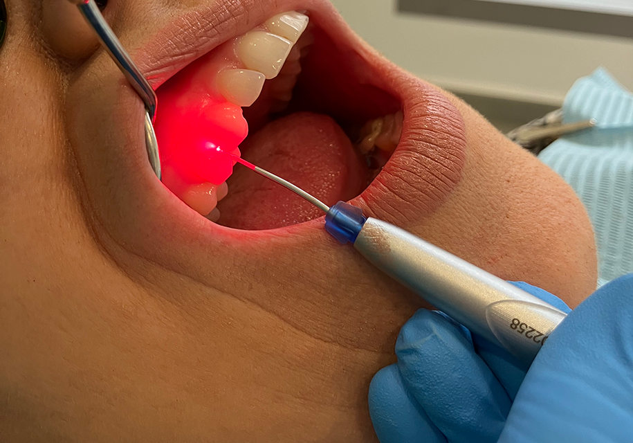 PERIODONCIA