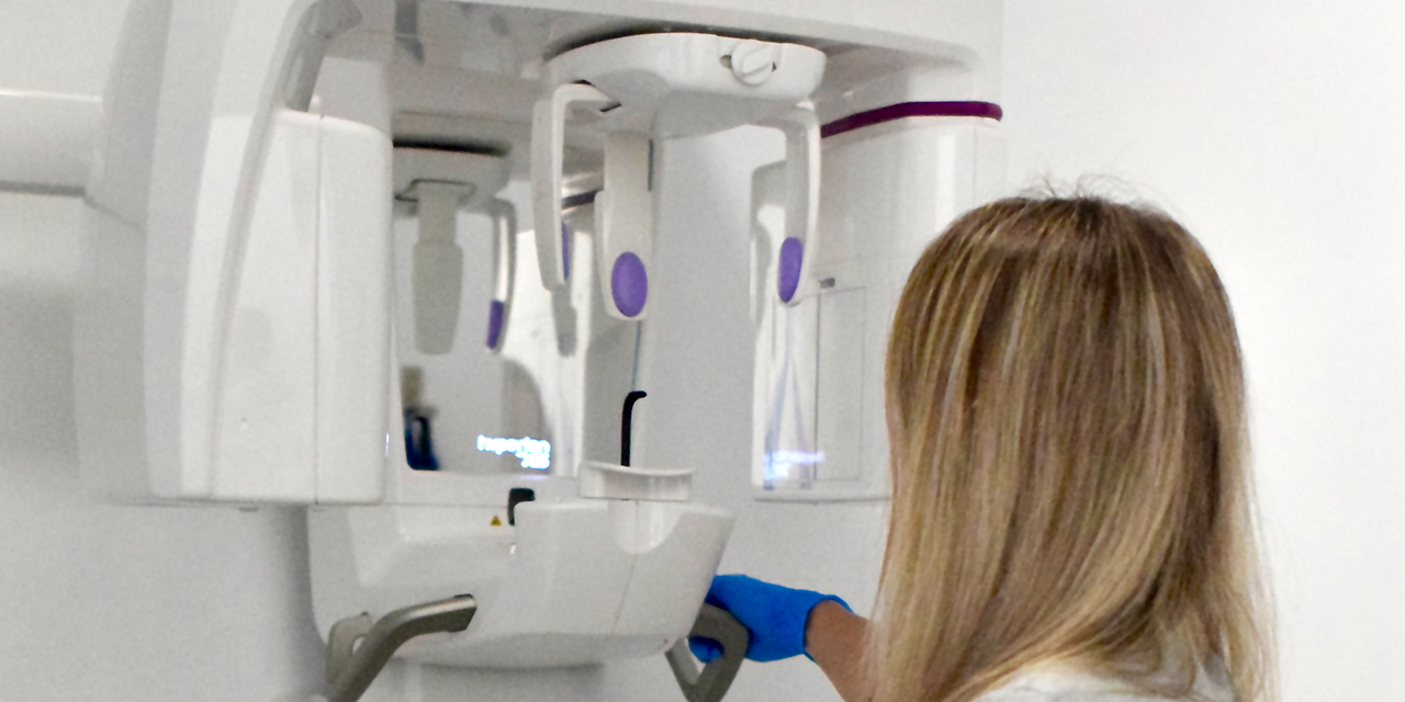 Todo lo que necesitas saber sobre los implantes dentales